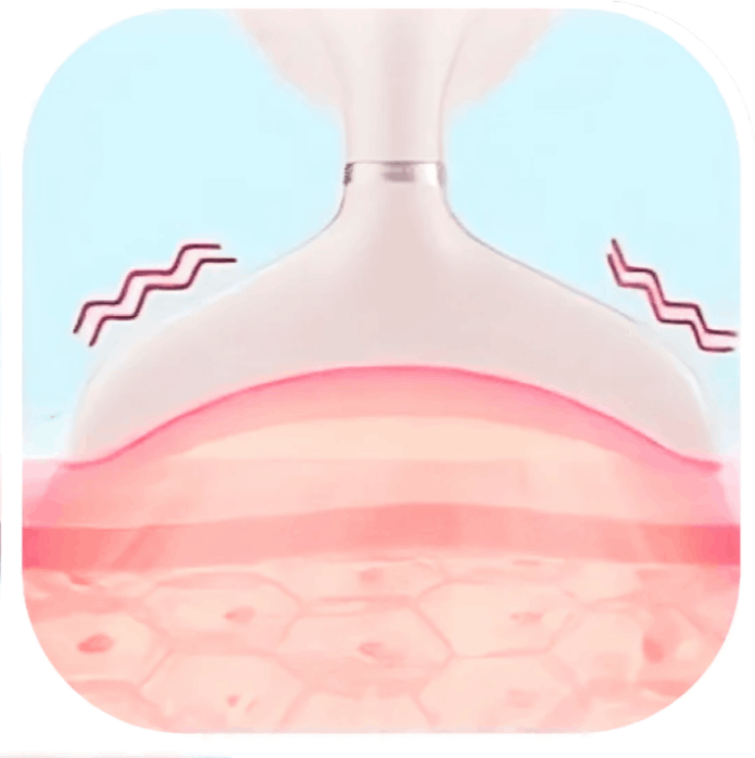 My Derma Dream